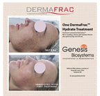Exquisite Laser Clinic  skin treatment Dermafrac 4 in 1 Skin Rejuvenation