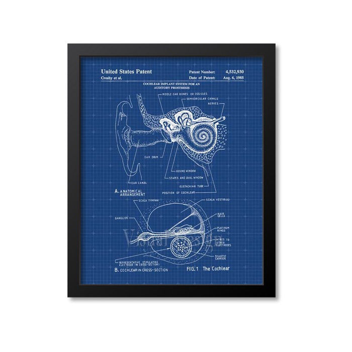 Cochlear Implant Patent Print