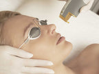 Exquisite Laser Clinic  skin treatment Laser Genesis Skin Rejuvenation Full Face