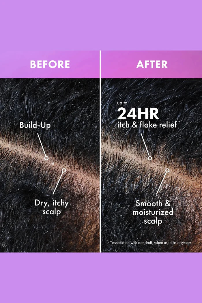MIELLE LAVENDER & LYCHEE SCALP MOISTURIZING SHAMPOO