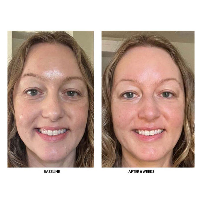 Peptide Eye Treatment