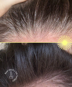 Ultimate Root Retouch Kit
