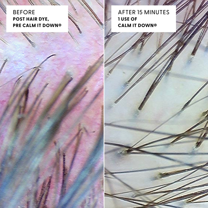 Close up image of a scalp before and after using Calm It Down. Before is red and irritated, after is healthy and clean.